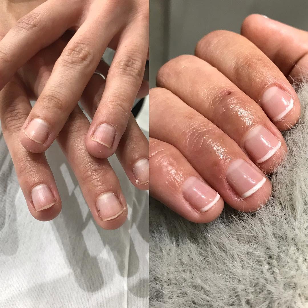 Uñas y Estética